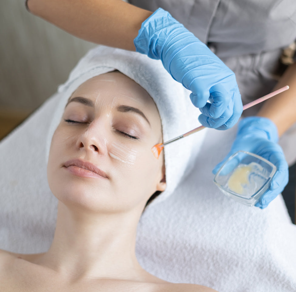 chemical peel treatment