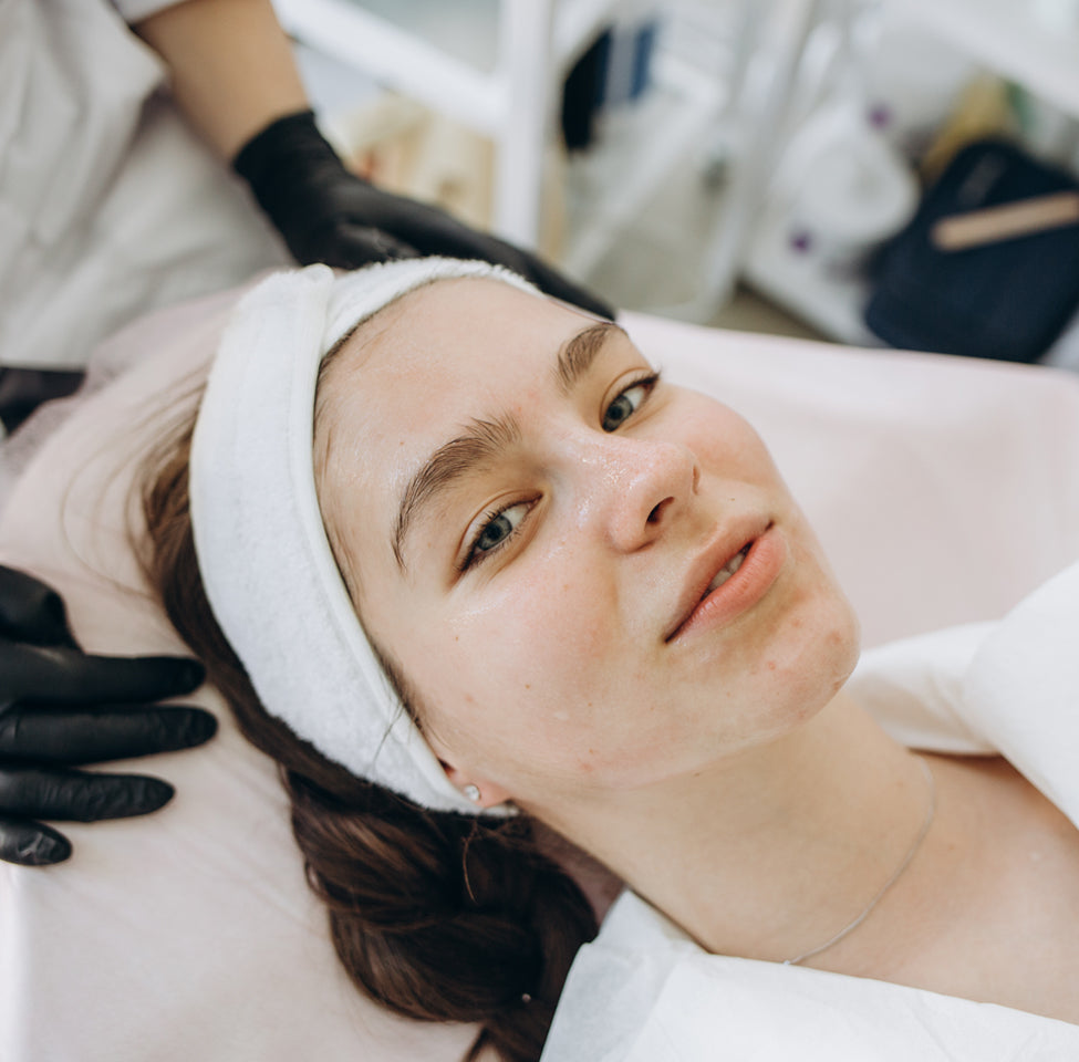 face peeling treatment