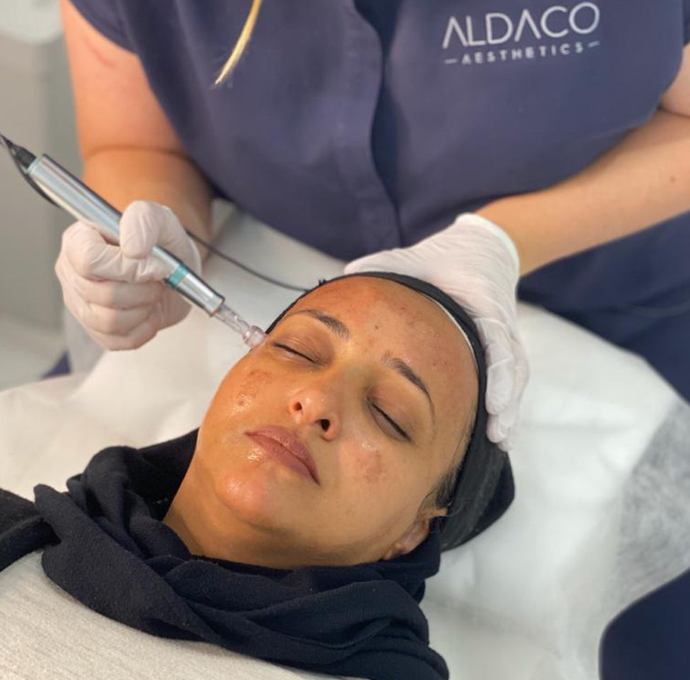 Micro Skin Needling Melbourne